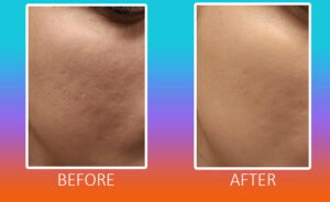 Deep Hydrating Natural Face Moisturizer for all skin types - Image 3